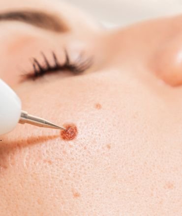 untitled design 2025 11 26t122458.146