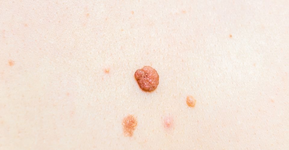 untitled design 2025 11 26t123623.091